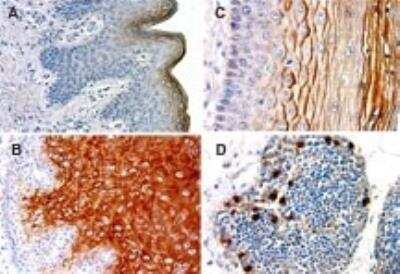 Immunohistochemistry-Paraffin: NLRP1/NALP1 Antibody [NB100-56148]
