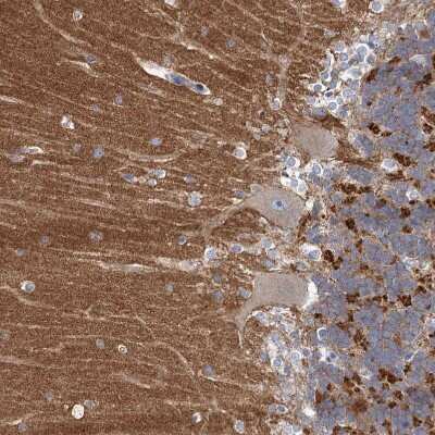 Immunohistochemistry-Paraffin: NLRP10/Pynod/NALP10 Antibody [NBP1-85557]