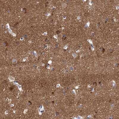 Immunohistochemistry-Paraffin: NLRP10/Pynod/NALP10 Antibody [NBP1-85557]