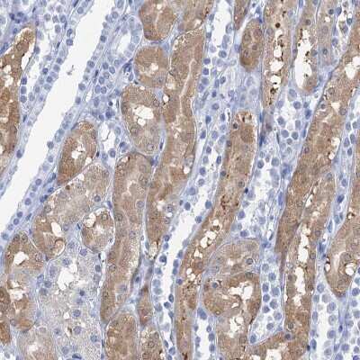 Immunohistochemistry-Paraffin: NLRP10/Pynod/NALP10 Antibody [NBP1-85557]