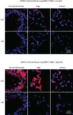 Immunohistochemistry-Paraffin: NLRP3/NALP3 Antibody - BSA Free [NBP1-77080]