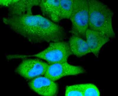 Immunocytochemistry/ Immunofluorescence: NLRP3/NALP3 Antibody (SC06-23) [NBP2-67639]