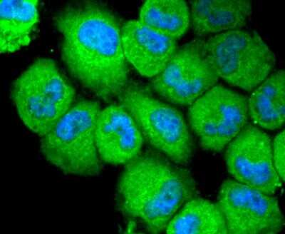 Immunocytochemistry/ Immunofluorescence: NLRP3/NALP3 Antibody (SC06-23) [NBP2-67639]