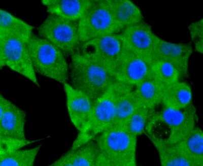 Immunocytochemistry/ Immunofluorescence: NLRP3/NALP3 Antibody (SC06-23) [NBP2-67639]