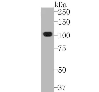 Western Blot: NLRP3/NALP3 Antibody (SC06-23) [NBP2-67639]