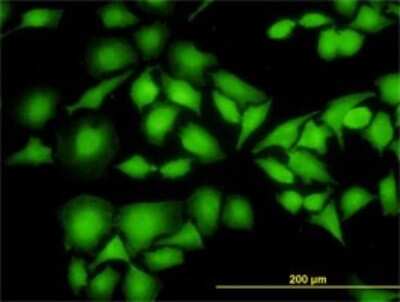 Immunocytochemistry/ Immunofluorescence: NM23-H1 Antibody (1D7) [H00004830-M02]