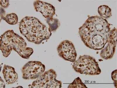 Immunohistochemistry-Paraffin: NM23-H1 Antibody (1D7) [H00004830-M02]