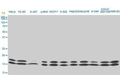Western Blot: NM23-H1 Antibody (1D7) [H00004830-M02]