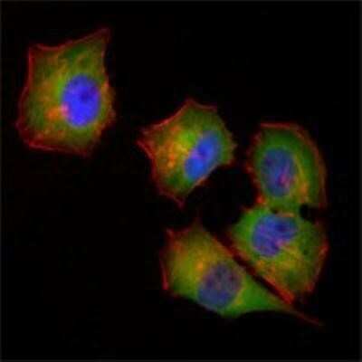 Immunocytochemistry/ Immunofluorescence: NM23-H1 Antibody (4B2) - BSA Free [NBP1-47398]