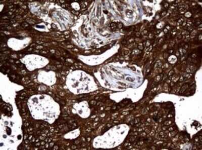 Immunohistochemistry: NM23-H1 Antibody (OTI4H2) [NBP2-46186]