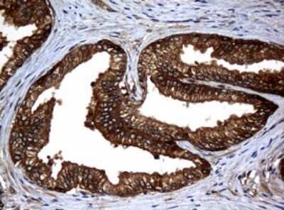 Immunohistochemistry: NM23-H1 Antibody (OTI4H2) [NBP2-46186]