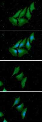 Immunocytochemistry/ Immunofluorescence: NM23-H1 Antibody (5F4) - BSA Free [NBP2-59498]