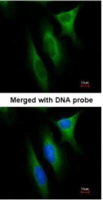 Immunocytochemistry/ Immunofluorescence: NM23-H1 Antibody [NBP1-30884]
