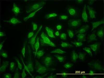 Immunocytochemistry/ Immunofluorescence: NM23-H2/NME2 Antibody (1A9) [H00004831-M09]