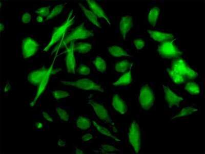Immunocytochemistry/ Immunofluorescence: NM23-H2/NME2 Antibody (1E4) [H00004831-M11]