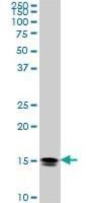 Western Blot: NM23-H2/NME2 Antibody (1E4) [H00004831-M11]