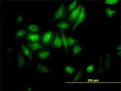 Immunocytochemistry/ Immunofluorescence: NM23-H2/NME2 Antibody (1F2) [H00004831-M08]