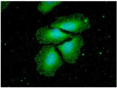 Immunocytochemistry/ Immunofluorescence: NM23-H2/NME2 Antibody (2E3) - BSA Free [NBP2-60241]