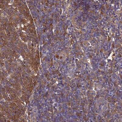 Immunohistochemistry-Paraffin: NM23-H1 Antibody [NBP2-13662]