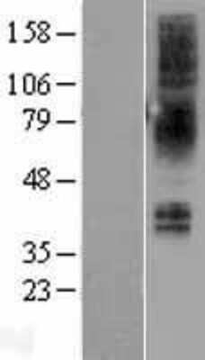 Western Blot: Neuromedin BR/NMBR Overexpression Lysate [NBL1-13680]