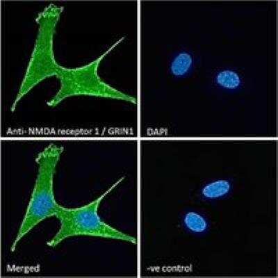 Immunocytochemistry/ Immunofluorescence: NMDAR1 Antibody [NB100-41105]
