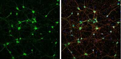 Immunocytochemistry/ Immunofluorescence: NMDAR1 Antibody [NBP3-13158]