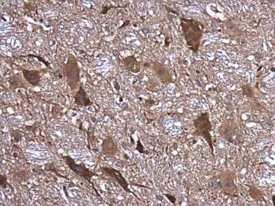 Immunohistochemistry-Paraffin: NMDAR1 Antibody [NBP3-13158]