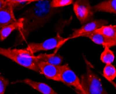 Immunocytochemistry/ Immunofluorescence: NMDAR1 Antibody (JM11-26) [NBP2-66982]