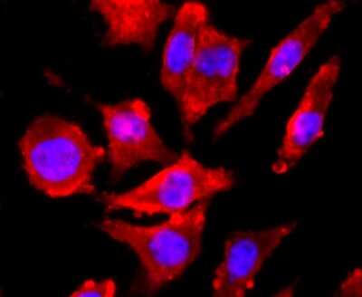 Immunocytochemistry/ Immunofluorescence: NMDAR1 Antibody (JM11-26) [NBP2-66982]