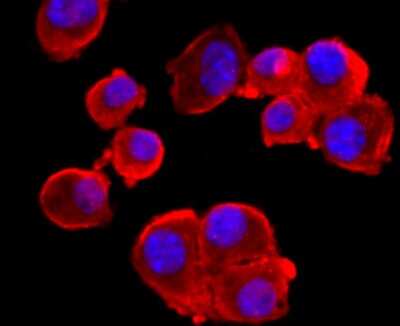Immunocytochemistry/ Immunofluorescence: NMDAR1 Antibody (JM11-26) [NBP2-66982]