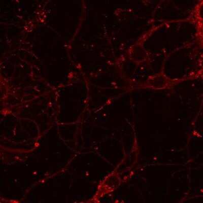 Immunocytochemistry/ Immunofluorescence: NMDAR1 Antibody (R1JHL) - Azide and BSA Free [NB300-118]