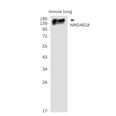 Western Blot: NMDAR2A Antibody (S03-2K3) [NBP3-19719]