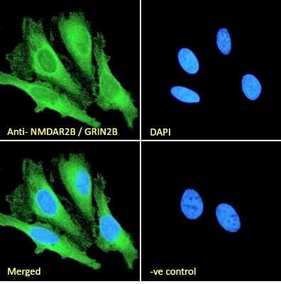 Immunocytochemistry/ Immunofluorescence: NMDAR2B Antibody [NB100-41097]