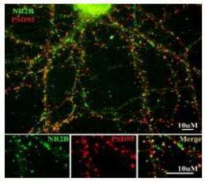 Immunohistochemistry: NMDAR2B Antibody [NBP1-30037]
