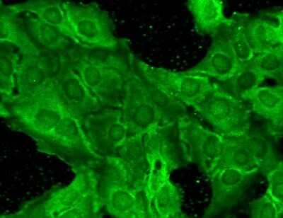 Immunocytochemistry/ Immunofluorescence: NMDAR2B Antibody (S59) [NBP1-47611]