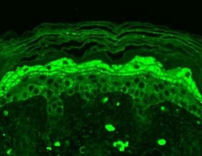 Immunohistochemistry: NMDAR2B Antibody (S59) [NBP1-47611]