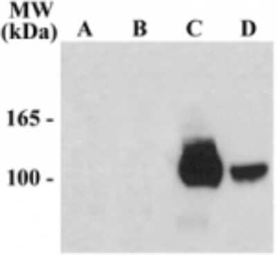 Western Blot: NMDA R, NR1 Subunit AntibodyPrime Splice VariantAzide and BSA Free [NB300-117]
