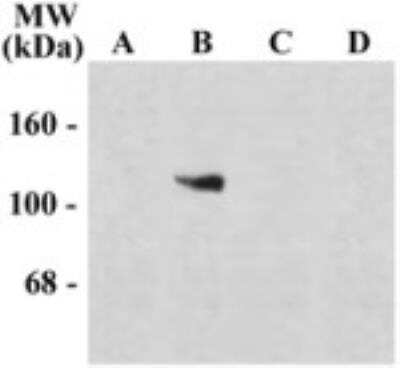Western Blot: NMDA R, NR1 Subunit AntibodySplice VariantAzide and BSA Free [NB300-116]