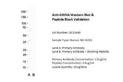 Western Blot: NMDARA1 Antibody [NBP2-85387]