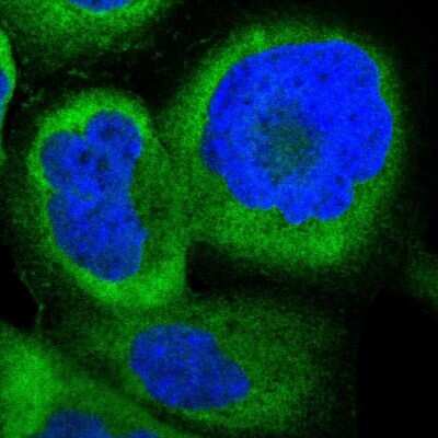 Immunocytochemistry/ Immunofluorescence: NM23-H1 Antibody [NBP1-80992]