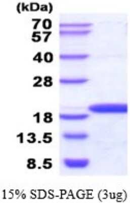 SDS-PAGE: Recombinant Human NME3 His Protein [NBP2-52260]