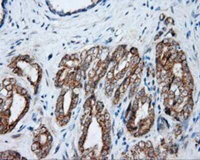 Immunohistochemistry-Paraffin: NME4 Antibody (OTI1A5) [NBP2-02487]