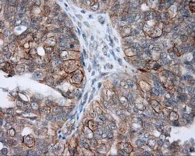 Immunohistochemistry: NME4 Antibody (OTI1A5) - Azide and BSA Free [NBP2-73005]