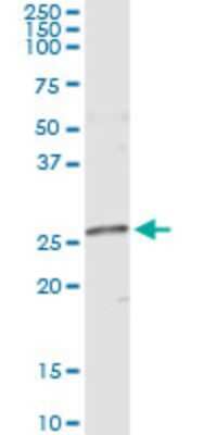 Western Blot: NME5 Antibody (4F5) [H00008382-M04]