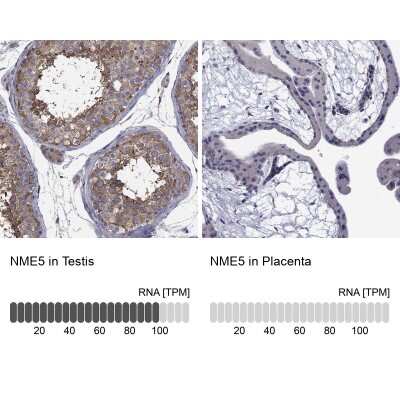 Immunocytochemistry/ Immunofluorescence: NME5 Antibody [NBP3-17061]