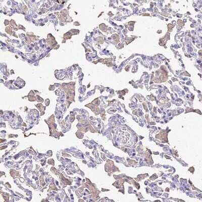 Immunohistochemistry-Paraffin: NME5 Antibody [NBP1-92188]