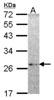 Western Blot: NME5 Antibody [NBP1-32207]