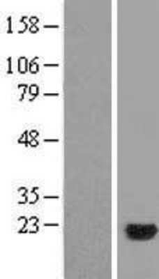 Western Blot: NME5 Overexpression Lysate [NBL1-13687]