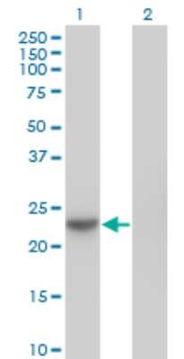 Western Blot: NME6 Antibody (2A10) [H00010201-M07]