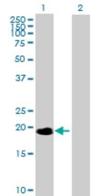 Western Blot: NME6 Antibody [H00010201-B02P]